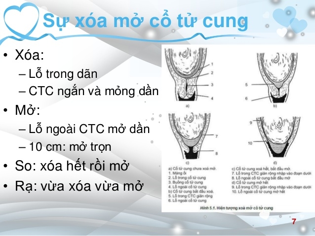 Cổ tử cung