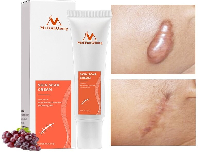 MeiYanQiong Acne Scar Removal Cream Skin Repair Stretch Marks giảm sẹo lồi, lõm, sẹo thâm
