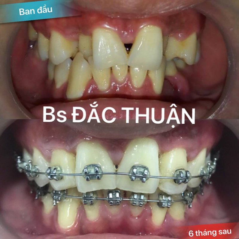 Tận hưởng 6 Món ngon ngất ngây trên phố Hàm Nghi, TP.HCM