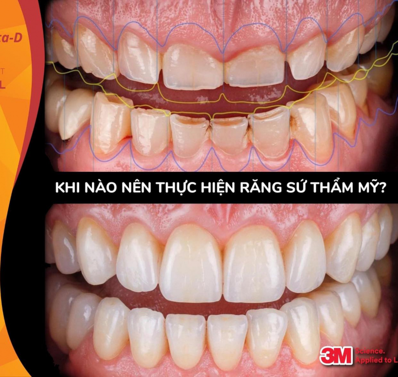 Nha khoa thẩm mỹ nice smile