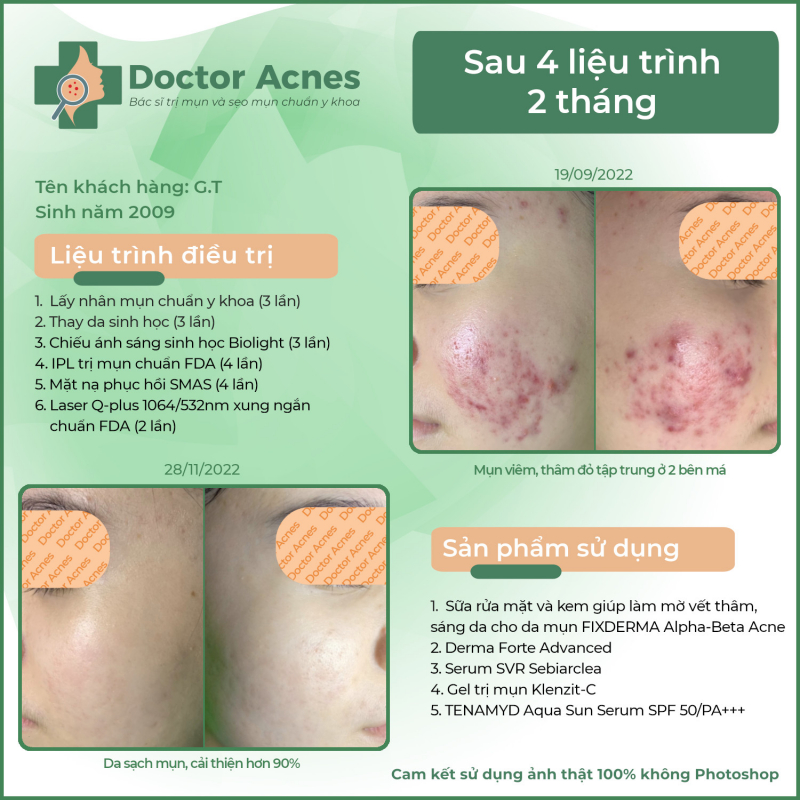 Phòng khám Da liễu chuyên trị mụn Doctor Acnes