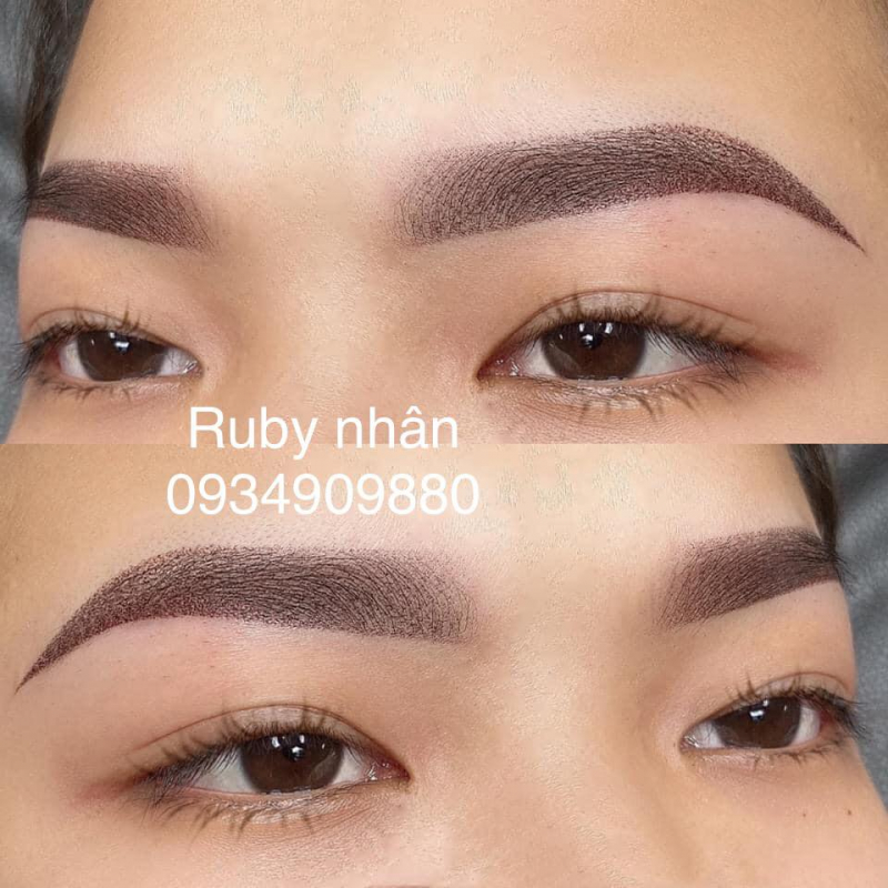 Thẩm Mỹ Quốc Tế Ruby Beauty Center