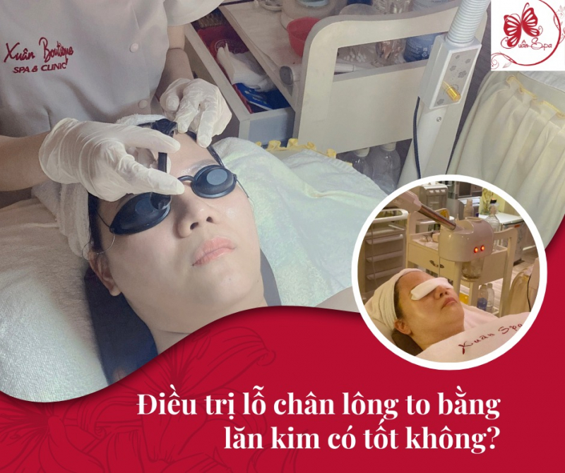 Xuân Spa Đà Nẵng